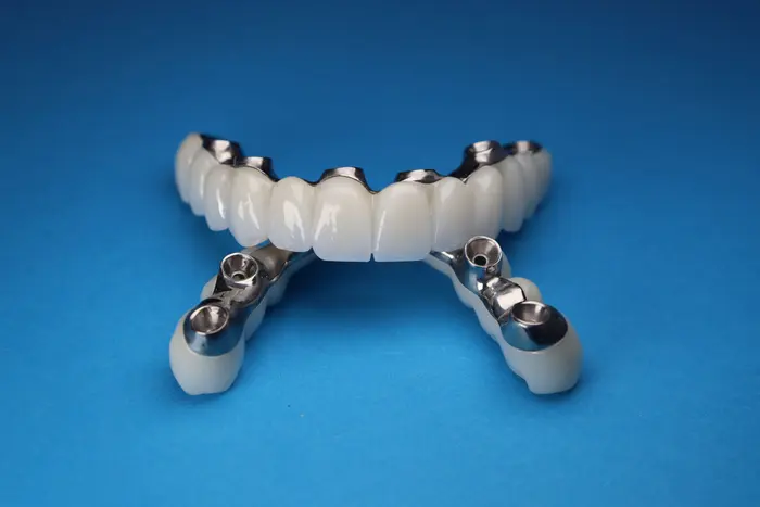 A full-arch dental prosthesis resting on four short metal posts, photographed on a blue surface.