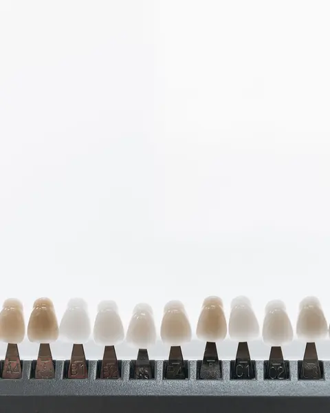 Porcelain veneers standing in a row on a display rack, in several shades.